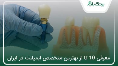 بهترین متخصص ایمپلنت در ایران