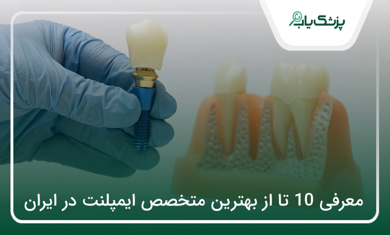 بهترین متخصص ایمپلنت در ایران
