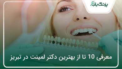 بهترین دکتر لمینت در تبریز