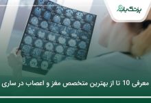 بهترین متخصص مغز و اعصاب در ساری