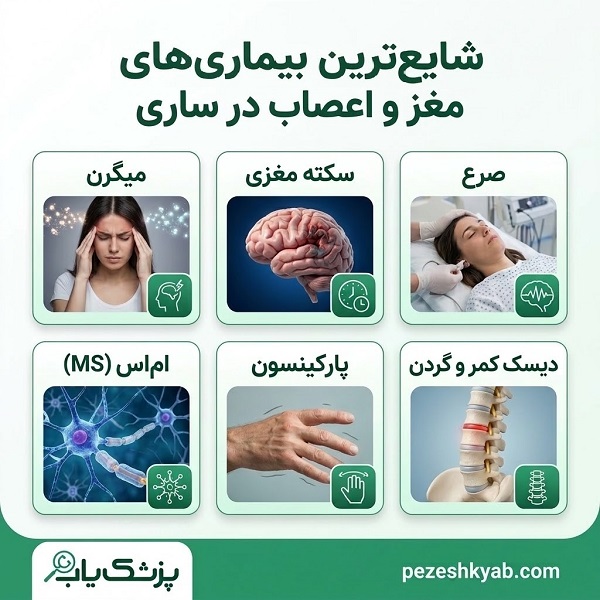 شایع ترین بیماریهای مغز و اعصاب در ساری