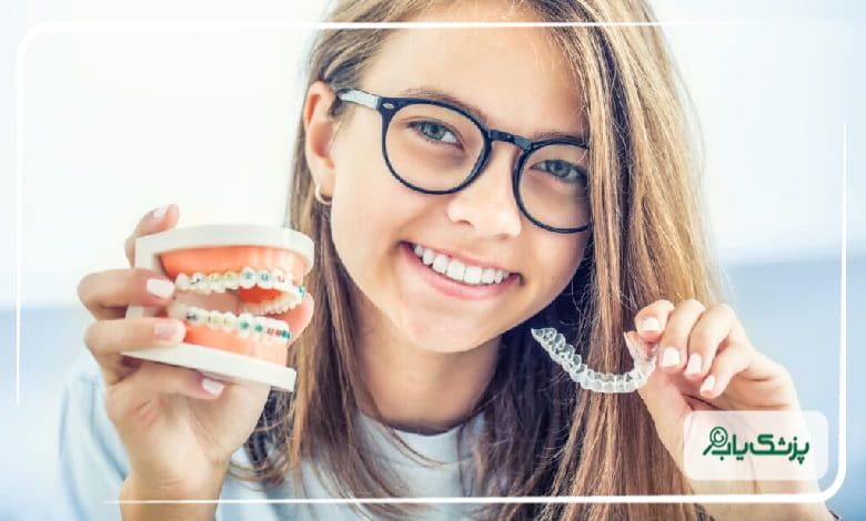 تفاوت ارتودنسی ثابت و متحرک؛ کدام بهتر است؟
