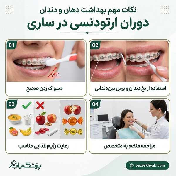 نکات مهم بهداشت دهان و دندان دوران ارتودنسی در ساری