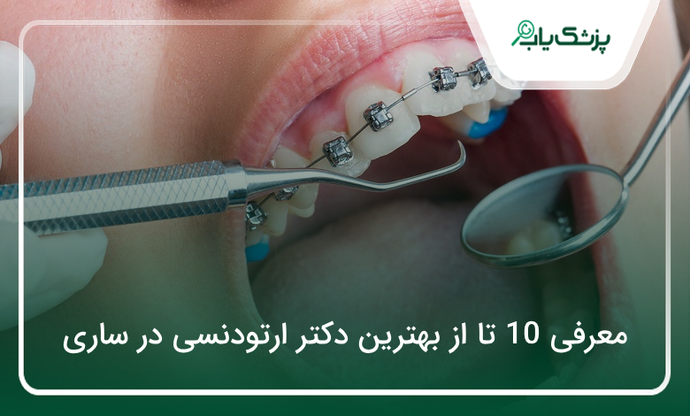 بهترین دکتر ارتودنسی در ساری