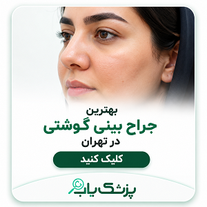 بهترین جراح بینی گوشتی در تهران