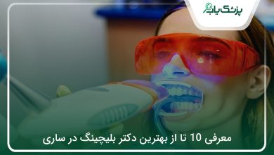 بهترین دکتر بلیچینگ در ساری