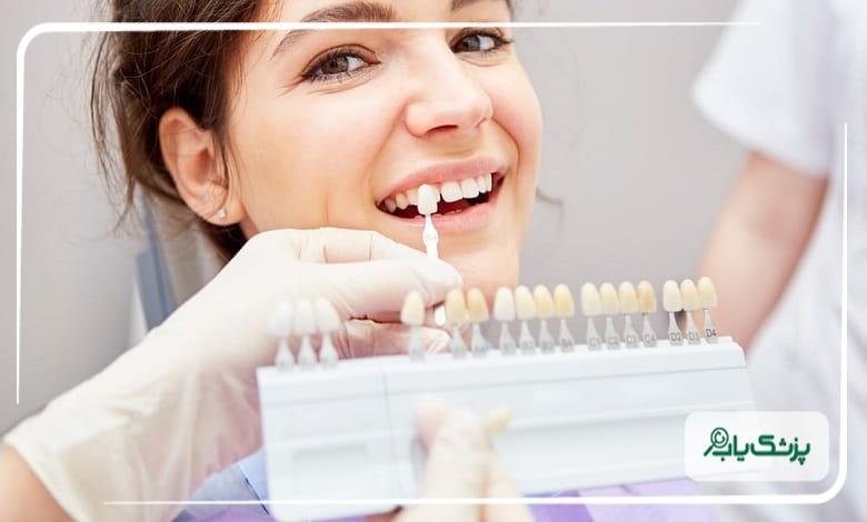علت زردی دندانها؛ آیا بلیچینگ برای همه مناسب است؟