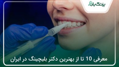 بهترین دکتر بلیچینگ در ایران