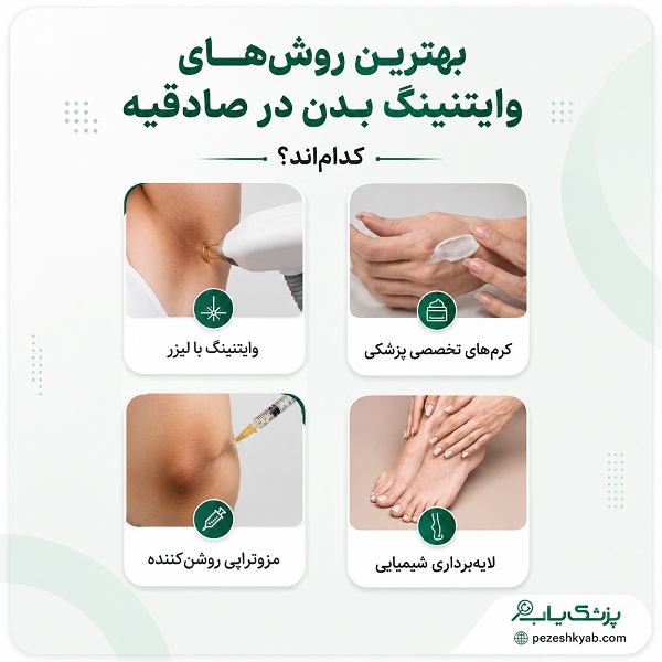 بهترین روشهای وایتنینگ بدن در صادقیه کداماند؟