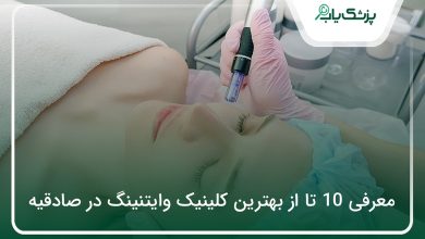 بهترین کلینیک وایتنینگ در صادقیه