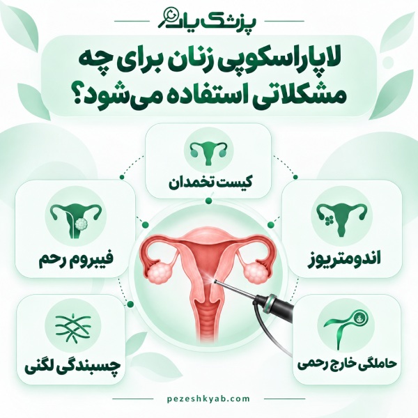 لاپاراسکوپی زنان؛ چه مشکلاتی را بررسی و درمان میکند؟