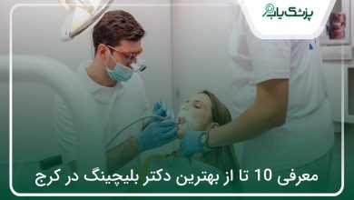 بهترین دکتر بلیچینگ در کرج