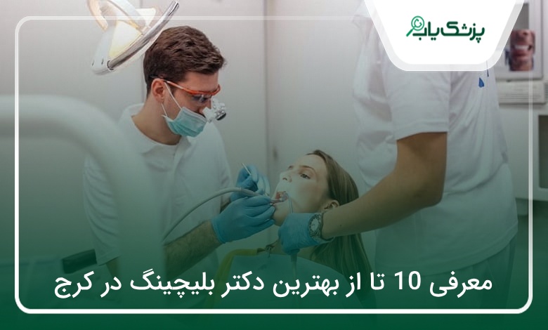 بهترین دکتر بلیچینگ در کرج