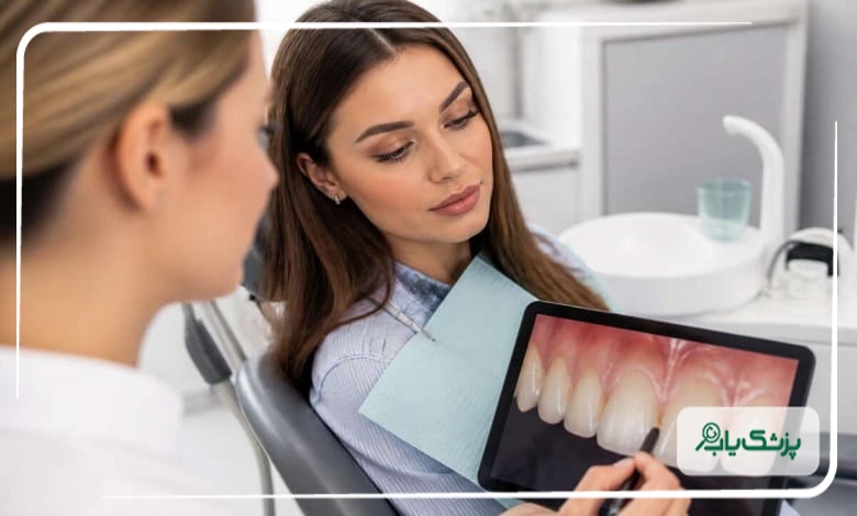 بلیچینگ دندان بهتر است یا کامپوزیت؟