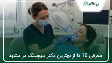 بهترین دکتر بلیچینگ در مشهد