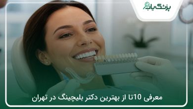 بهترین دکتر بلیچینگ در تهران