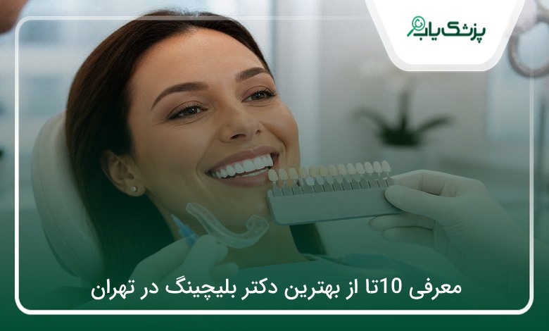 بهترین دکتر بلیچینگ در تهران