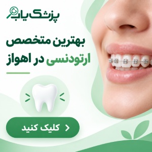 بهترین دکتر لمینت دندان در اهواز چه ویژگیهایی دارد؟