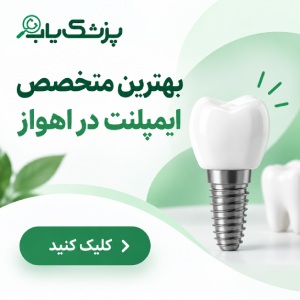 بهترین دکتر لمینت دندان در اهواز چه ویژگیهایی دارد؟
