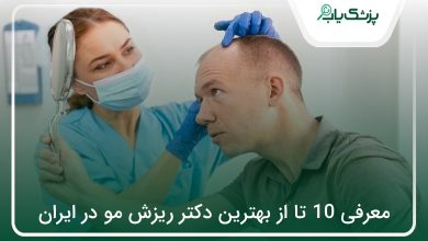 بهترین دکتر ریزش مو در ایران