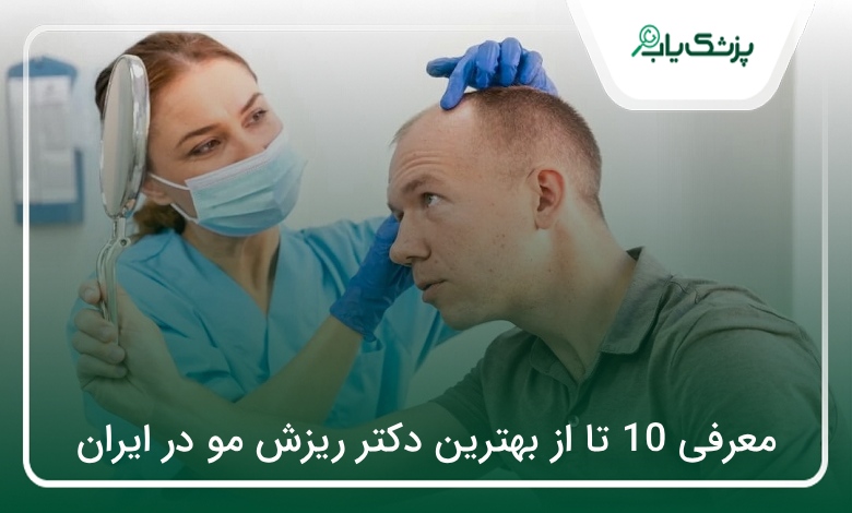 بهترین دکتر ریزش مو در ایران