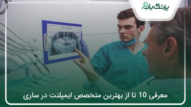 بهترین متخصص ایمپلنت در ساری