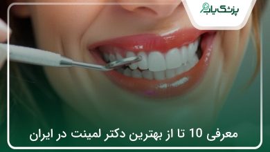 بهترین دکتر لمینت در ایران