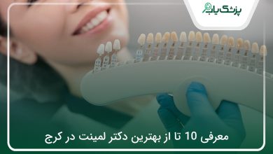 بهترین دکتر لمینت در کرج