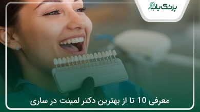 بهترین دکتر لمینت در ساری