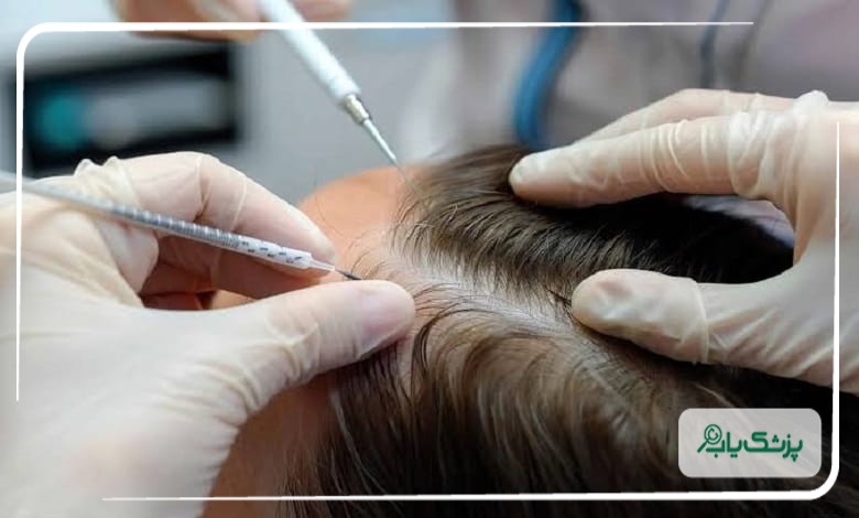 مقایسه مزوتراپی و PRP؛ کاربرد، ماندگاری و هزینه