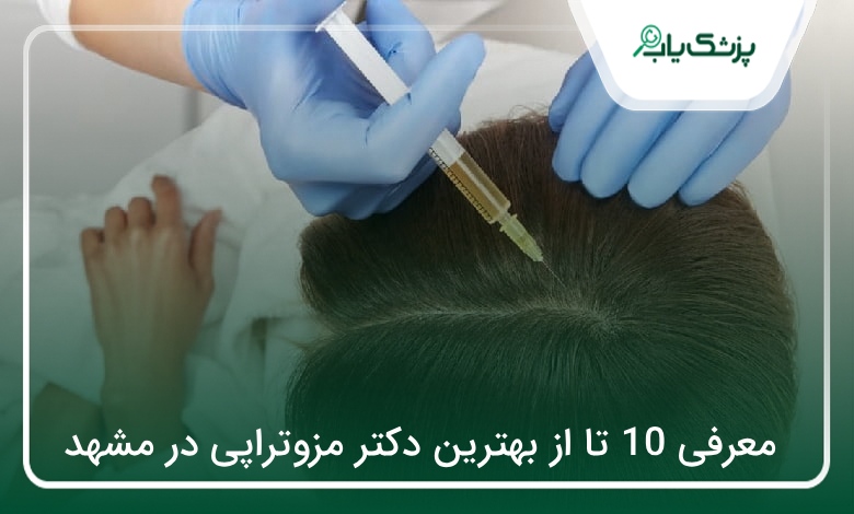 بهترین دکتر مزوتراپی در مشهد