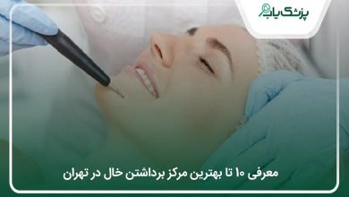 بهترین مرکز برداشتن خال در تهران