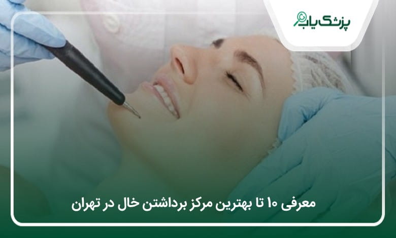 بهترین مرکز برداشتن خال در تهران