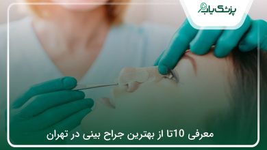 بهترین جراح بینی در تهران