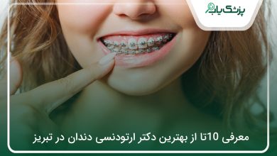 بهترین دکتر ارتودنسی در تبریز