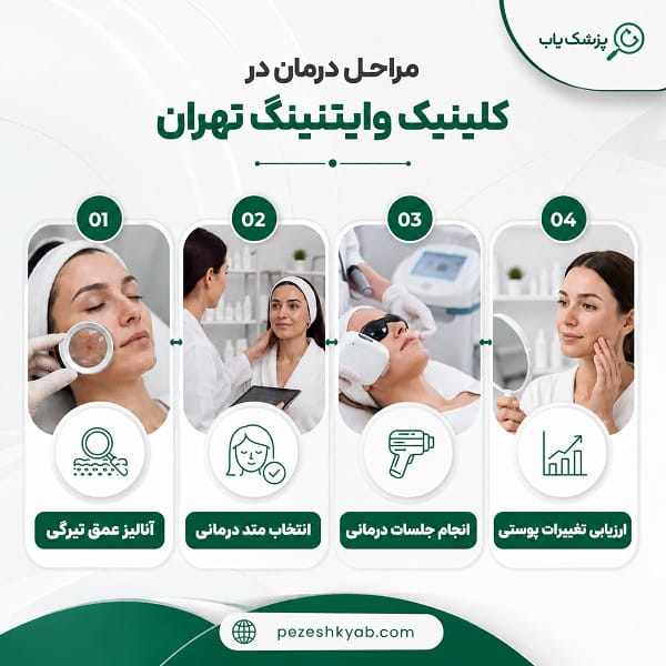 مراحل درمان در کلینیک وایتنینگ تهران