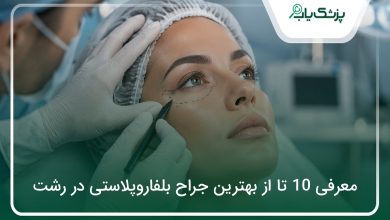 بهترین جراح بلفاروپلاستی در رشت