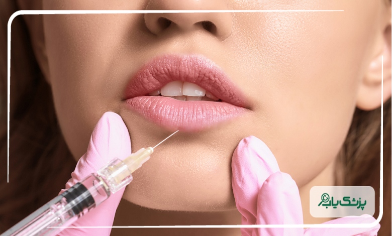 تزریق ژل لب حرفه ای در رشت